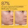 imageNutrafol Clear Skin Acne Supplement for Women Clinically Tested for Clearer Smoother Skin PhysicianFormulated Vegan1 Bottle 120 Count
