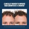imageNutrafol Mens Hair Growth Supplements Clinically Tested for Visibly Thicker Hair and Scalp Coverage Dermatologist Recommended  2 Month Supply 2 Refill Pouches