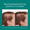 imageNutrafol Womens Balance Hair Growth Supplements Ages 45 and Up Clinically Proven for Visibly Thicker Hair and Scalp Coverage in 36 Months Dermatologist Recommended  1 Month Supply Refill Pouch